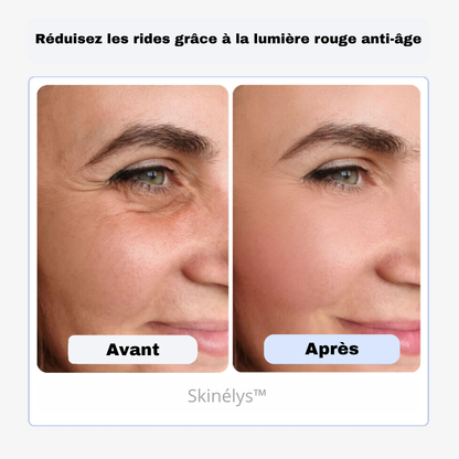 Skinélys™ – Soin facial LED nouvelle génération